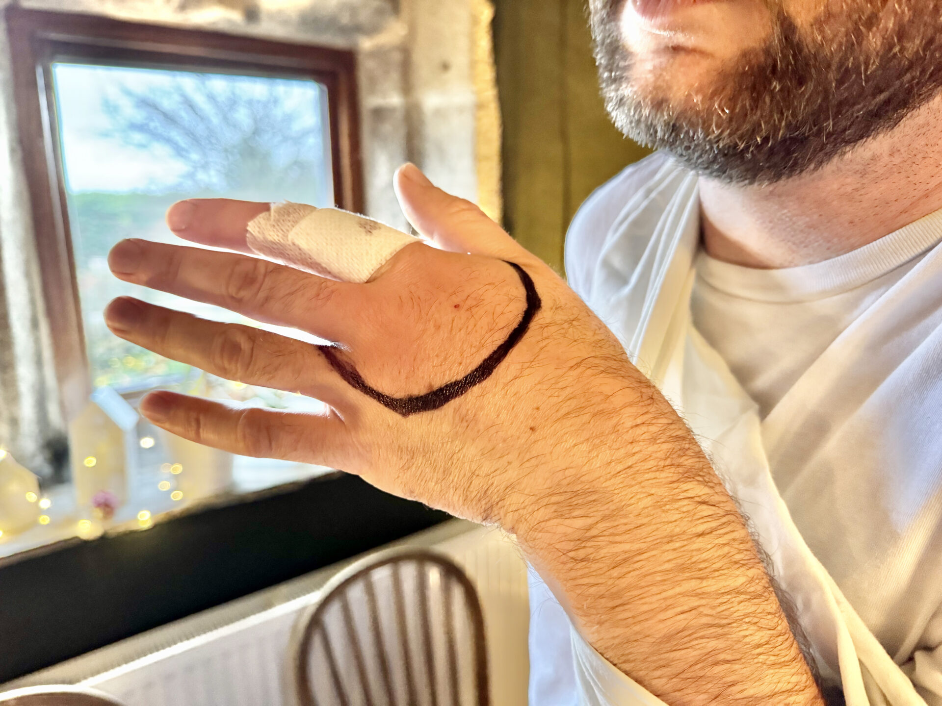 Contaminated cuts and bites from gardening